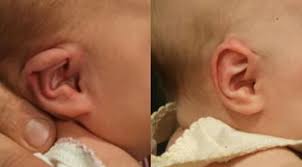 نتیجه جستجوی لغت [constricted] در گوگل