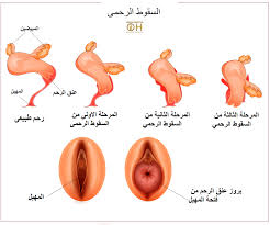 مكنك تقوية عضلات الحوض من خلال تمارين كيجل انتظرونا فىي معلومة فى كبسولة العلاج Tipps Haushalts Tipps Haushalt