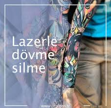 Renkli Dovmeler Silinir Mi Renkli Dovmelerin Silinmesinde Hicbir Zorluk Yoktur Bu Yuzden Renkli Dovmeler Silindikten Sonrada Renkli Dovmeler Dovme La Luna