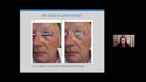 CRI-CONF 2021: Elisabeth Bik "Image duplication detection tools — insights  from a human spotterl"