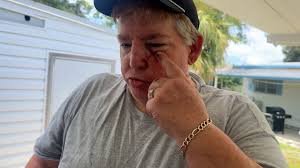 Pinellas Park couple fends off armed home invader