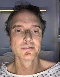 Sudden cardiac arrest: Wife saves husband's life with CPR