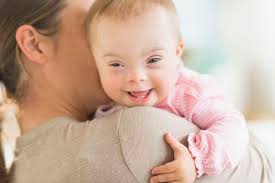Breastfeeding A Child With Down Syndrome