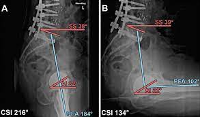 This article provides an overview of normal anatomy of the pelvic floor as seen on magnetic resonance imaging, ultrasound, and fluoroscopic studies performed in. A And 4 B Standing And Sitting Lateral Spine Pelvis Hip Radiographs Of Download Scientific Diagram