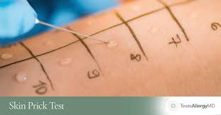 Image result for Skin Testing