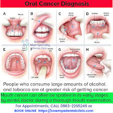 Pin On Dental Hygenist
