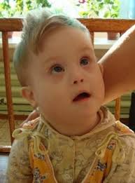 Down Syndrome Daily: December 2011