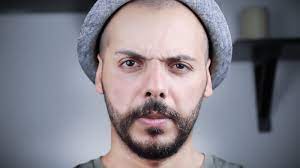 Is It Okay To Wear A Hat After Hair Transplant Estenove Hair Transplant