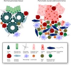 Nathan bolton has taken a leadership role at the ochsner medical center in new orleans in the often complex treatment of peritoneal mesothelioma cancer. Pancreatic Ductal Adenocarcinoma Biological Hallmarks Current Status And Future Perspectives Of Combined Modality Treatment Approaches Radiation Oncology Full Text