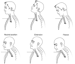 This is cervical spine (neck) extension + flexion by alberta blue cross on vimeo, the home for high quality videos and the people who love them. Mobility Of The Trachea With Flexion And Extension Of The Neck Download Scientific Diagram
