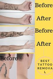 The article describes different ways of tattoo removal, their cost, and pain/ painless procedures press enter to begin your search. How To Easily Remove Temporary Tattoos Quora
