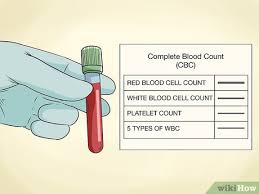 Cellsearch is fda approved for use in breast they don't permit any kind of blood testing in solid tumors to monitor disease status or treatment response. How To Detect Cancer With A Blood Test 9 Steps With Pictures