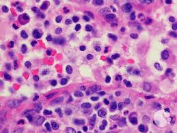 Image result for Mast Cell