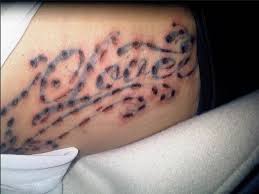Plastic Surgeons And Tattoo Removalists Call For More Regulation Of The Laser Tattoo Removal Industry