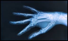 Osteomyelitis Coding In Icd 10 Ensure Specificity