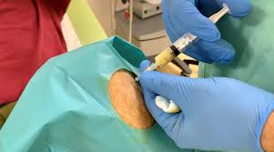 A tratat până acum 9000 de pacienţi români şi doar 18 au primit banii înapoi dacă tratamentul lui nu a funcţionat. Exclusiv Terapia Minune Contra Durerii Un Medic Roman A Uimit Planeta Cum ReuÈeÈte SÄ Vindece Bolile Considerate De MulÈi Incurabile