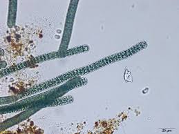 Image result for Microcoelia nyungwensis