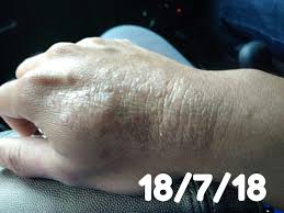 Vremea in tanjung tualang pentru astăzi, mâine și săptămâna. Teratak S Orlylove Allahuakbar Alhamdullilah Sembuh Juga Penyakit Misteriku