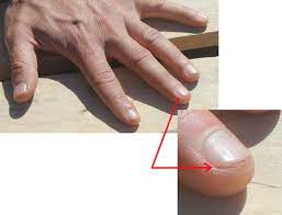 Wie Formt Und Pflegt Mann Die Fingernagel