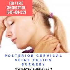 Posterior Cervical Spine Fusion Surgery Sternocleidomastoid Muscle Cervical Forward Head Posture