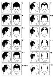 In medical terms, some may even refer to it as androgenetic alopecia, and such. What Causes Hair Loss In Men Thymuskin