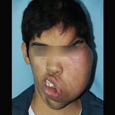 Nació con una extraña malformación y lograron hacerle una cirugía que le  cambió la vida