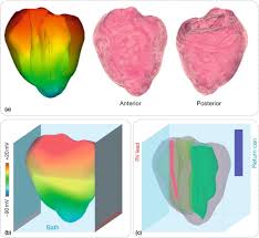 Shows how to use the defibrillator and different ways to place the paddles with discussion of how to choose. Defibrillation An Overview Sciencedirect Topics