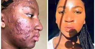 South Sudan Hip Hop Music Industry