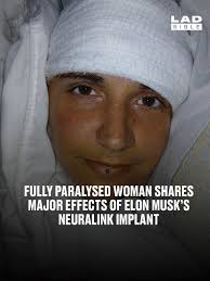 She has been unable to move since a car crash aged 16.