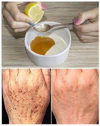 Comment Enlever Les Taches Et Les Rides Des Mains Naturellement Skin Care Essentials Hand Care Beauty Box