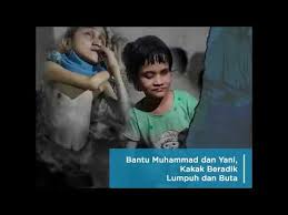 Kalau bukan sekarang, kapan lagi? Sharing Happiness Bantu Kakak Beradik Sembuh Dari Lumpuh Dan Buta