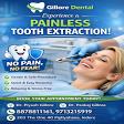 Painless tooth extraction product image