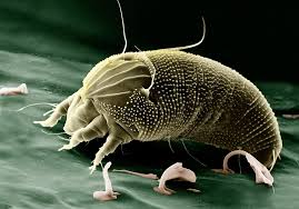 See full list on healtholino.com How To Get Rid Of Chigger Bugs Naturally Bugwiz