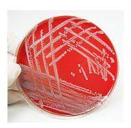 Impetigo, piodermite, stafilodermii, pneumonie stafilococica, sindromul sss. Cat De Periculoase Sunt Bacteriile Care Traiesc In Nas