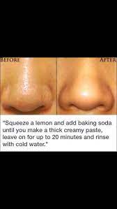 best proven remedies to reduce and shrink skin pores exposed skin care skin care treatments beauty skin care