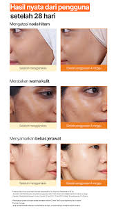 Jual Buy 1 Get 4 Innisfree Vitamin C Green Tea Enzyme Brightening Serum  30ml Bundle