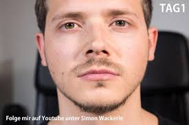 Minoxidil Bart Erfahrungsbericht über zwei Jahre mit Bildern