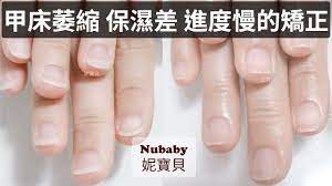 咬指甲矯正案例 會計新鮮人的壓力 甲床萎縮保濕差進度慢的矯正 nails