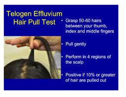 Image result for Hair Pull Test