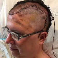 Fundraiser for Kristy Bales Caldwell by Jenny Bales Ladig : Kristy (Bales)  Caldwell Campaign