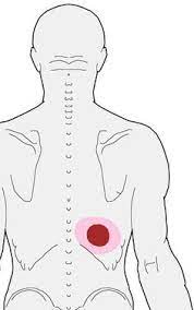 Anatomy of right side of back of rib cage. Rib Pain