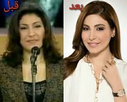 Jul 01, 2021 · وجه سامح سامي زوج الفنانة هالة صدقي تهديدا حادا لها مؤكدا أنه لن يرحمها، وكرر الادعاء بأن ولديه ليسوا منها ولكن من أم بديلة، وعلى عكس تصريحات سابقة لهالة صدقي، أشار سامح إلى أن قضية التشكيك في نسب الطفلين إليها لا زالت. Ø¨Ø§Ù„ØµÙˆØ± Ù†Ø¬Ù…Ø§Øª Ø§Ù„ÙÙ† Ù‚Ø¨Ù„ ÙˆØ¨Ø¹Ø¯ Ø¹Ù…Ù„ÙŠØ§Øª Ø§Ù„ØªØ¬Ù…ÙŠÙ„ ÙÙ† Ø¬Ø±ÙŠØ¯Ø© Ø§Ù„Ø²Ù…Ø§Ù†