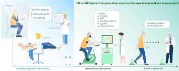 Image result for Exercise in COPD