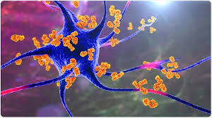 Image result for Autoimmunity