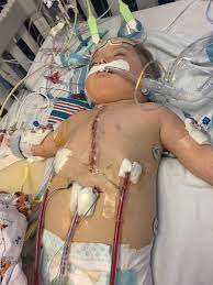 Raising Awareness for Congenital Heart Defects During American Heart Month
