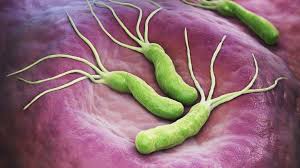 أعراض جرثومة المعدة وعلاجها.. وماذا عن العسل والثوم؟ | صحة | الجزيرة نت