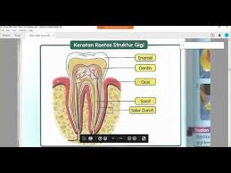 Seorang anak usia 3 tahun meninggal akibat kesalahan prosedur saat periksa ke dokter gigi anak di stockton, california, amerika serikat. Sains Tahun 3 Manusia Jenis Gigi Dan Kerat Rentas Gigi Youtube