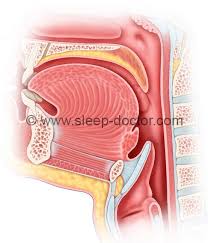 Image result for Tonsillectomy