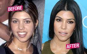 Jun 20, 2021 · a post shared by kourtney kardashian (@kourtney_.kardash) the sweet post came just hours before kourt was seen on a los angeles rooftop supporting her beau alongside megan fox , 35, and her. Kourtney Too Kardashian Had Surgery Like Her Sisters Top Docs Claim
