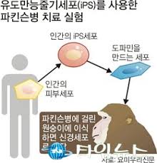 Maybe you would like to learn more about one of these? ì ê·¹ì  ì„± Sex ìƒí™œ íŒŒí‚¨ìŠ¨ë³' ì¦ìƒ ëˆ„ê·¸ëŸ¬ëœ¨ë ¤ ì„œìš¸íƒ€ìž„ë‰´ìŠ¤